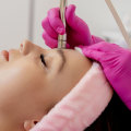 Microdermabrasion: A Comprehensive Guide to Non-Invasive Cosmetic Treatments in Glasgow